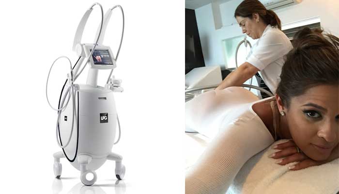 celebrity-endermologie-cellulite-treatments