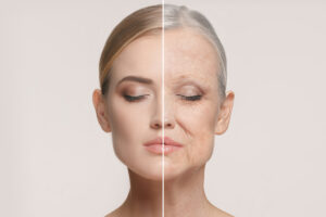 the visible effects of facial aging and how to prevent wrinkles